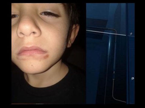 KNOX COUNTY SCHOOL BUS DRIVER ACC-- USED OF TAPING STUDENT'S MOUTH SHUT